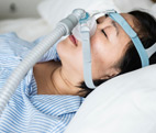 Sleep Apnea Sleep Apnea